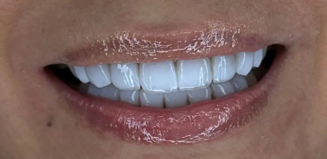 4_result