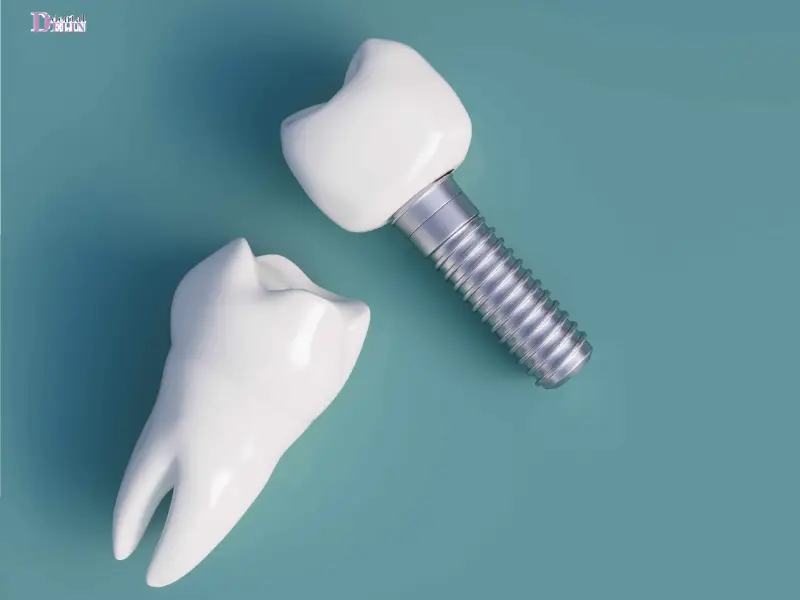 ایمپلنت برای افراد دیابتی ممکن شد